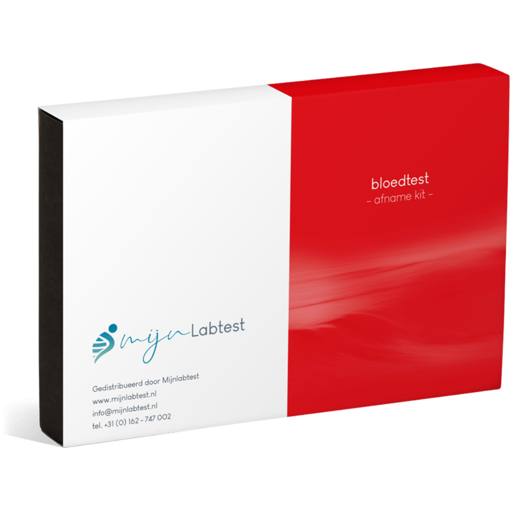 Voedsel Intolerantie Test pro